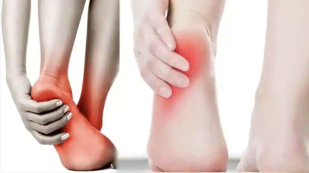 heel-pain-what-are-the-possible-causes