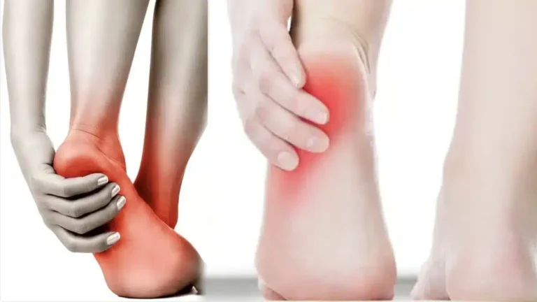 heel-pain-what-are-the-possible-causes