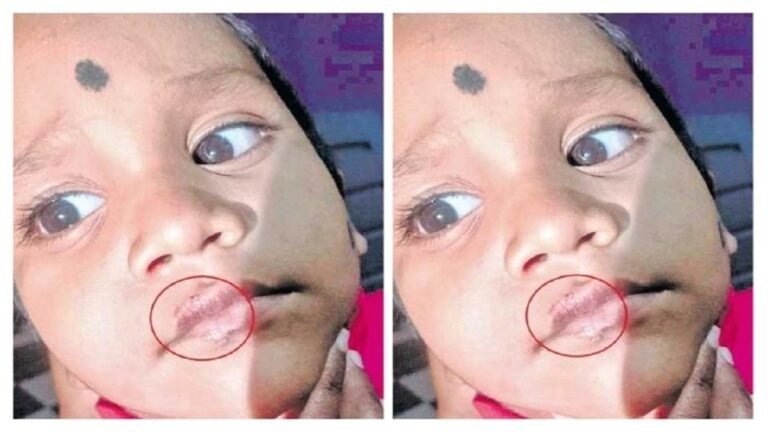 Child beat