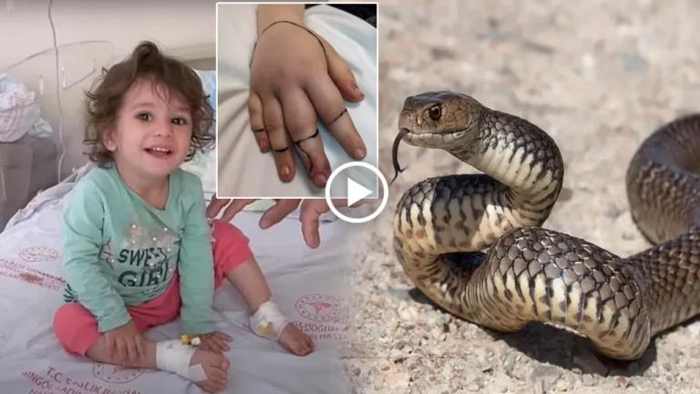 Toddler Revenge : Brave Boy kills 20-inch snake her teeth in revenge for biting her lip