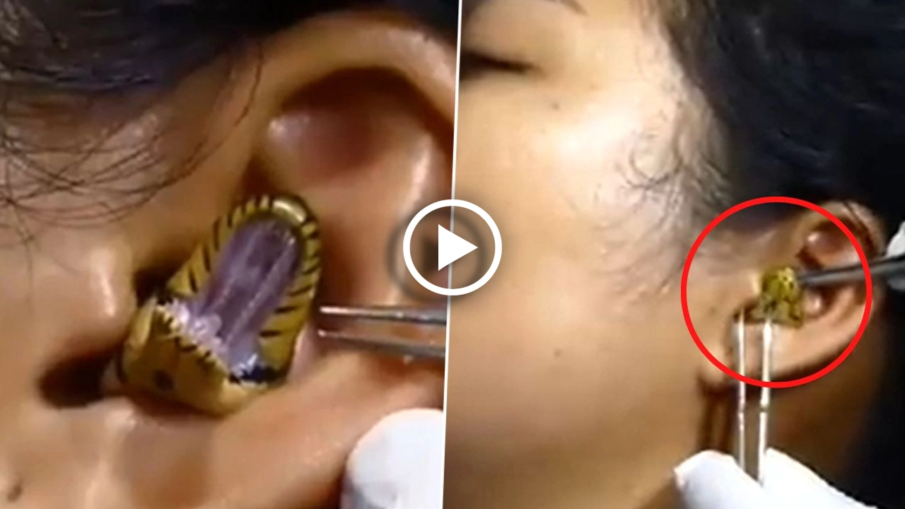Viral Video _ Snake gets stuck in woman's ear, refuses to come out, Video Viral
