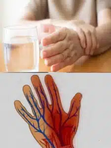 nerves weakness home remedies in telugu