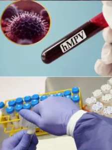 How Much HMPV test cost in India Telugu