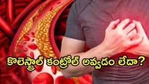 Cholesterol Levels